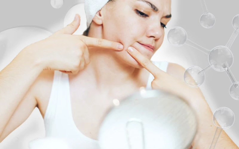 Clear Skin Ahead: Your Guide to Acne Treatment