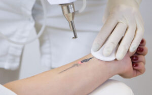 Laser Breakthrough: Unleashing Powerful Innovations For A Brighter Future